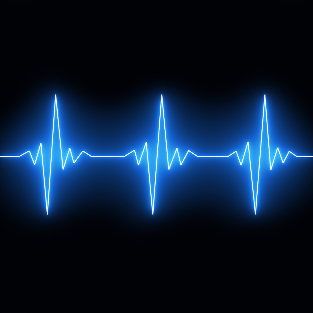 A blue waveform on a cardiac monitor.
