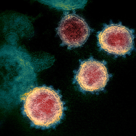 The World Health Organization declared COVID-19 to be a pandemic on April 11, 2020.