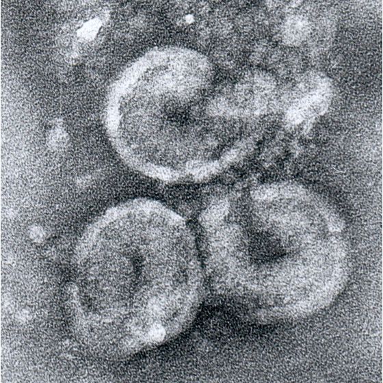 The virus that causes measles also belongs to the Coronaviridae family. 