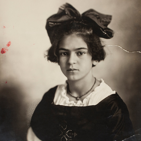 Frida Kahlo a contracté la poliomyélite à l’âge de six ans.