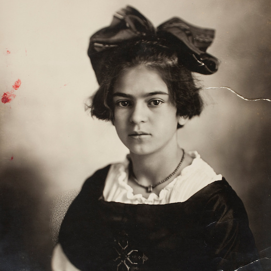 Frida Kahlo contracted poliomyelitis at the age of 6.