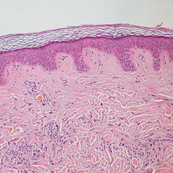 The dermis is made largely of elastin.