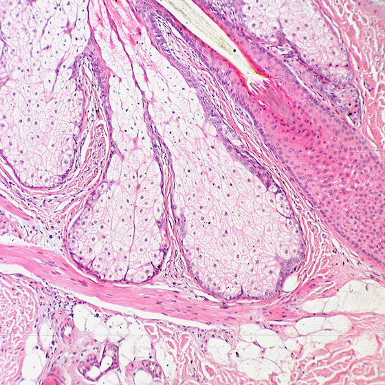 The epidermis regenerates every 5 to 7 days.