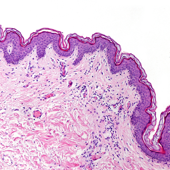Staphylococcus are the most common bacteria found on the skin.