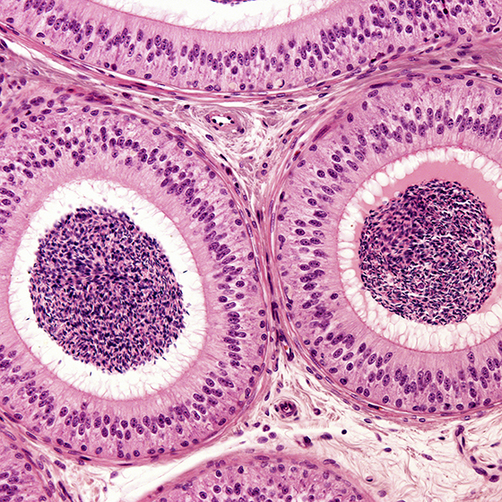 The male reproductive system has two epididymides.