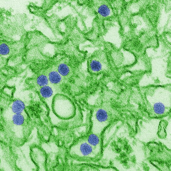ie-de-zika-de-2015-a-surtout-touche-l-amerique-du-sud