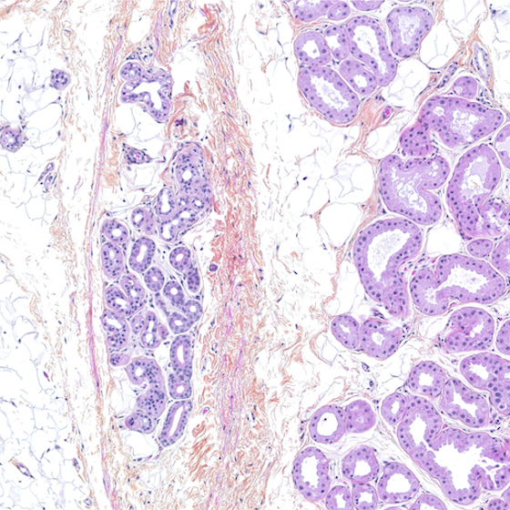 Skin contains fewer apocrine sweat glands than eccrine sweat glands.