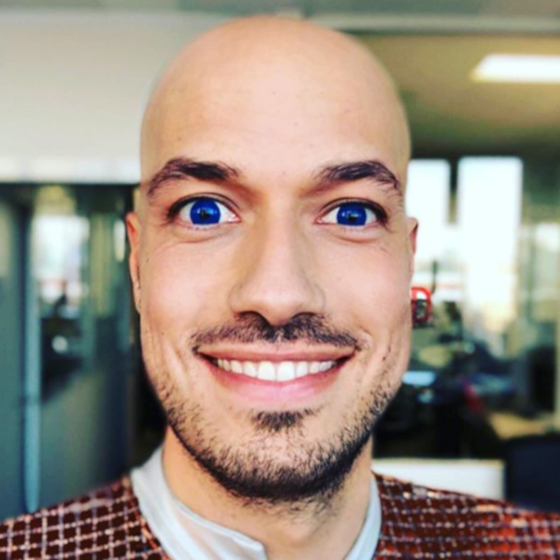 Carlito est chauve depuis l’adolescence.