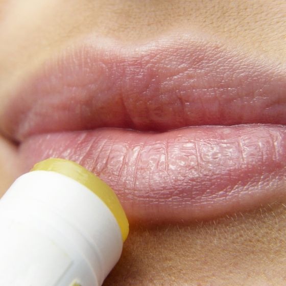 More than half of the world's population suffers from herpes.