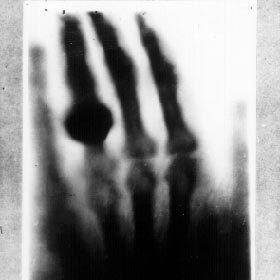 La première radiographie a été celle de la main d’une femme.