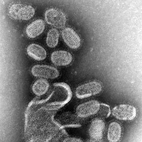 Chaque année, la grippe (influenza) tue 20 000 personnes dans le monde.